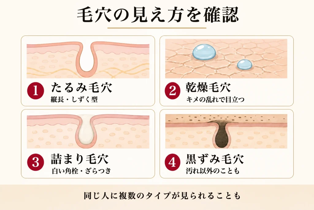 50代に多い四つの毛穴タイプ図